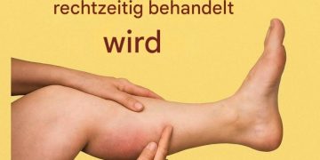Die 6 besten Infusionen für gesunde Arterien