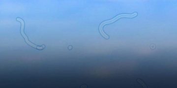 Was sind Mouches volantes? Das sollten Sie tun, wenn Sie sie sehen