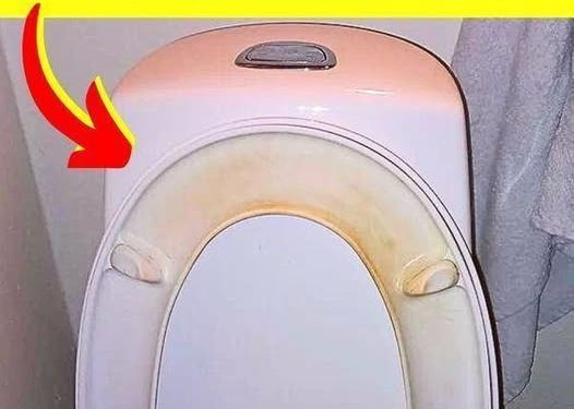 Der Trick, um gelbe Flecken auf dem WC-Sitz zu entfernen