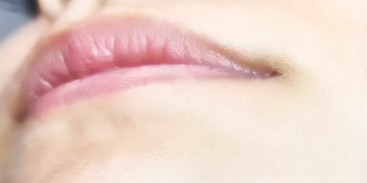 Kinnhaare bei Frauen: Was bedeutet das